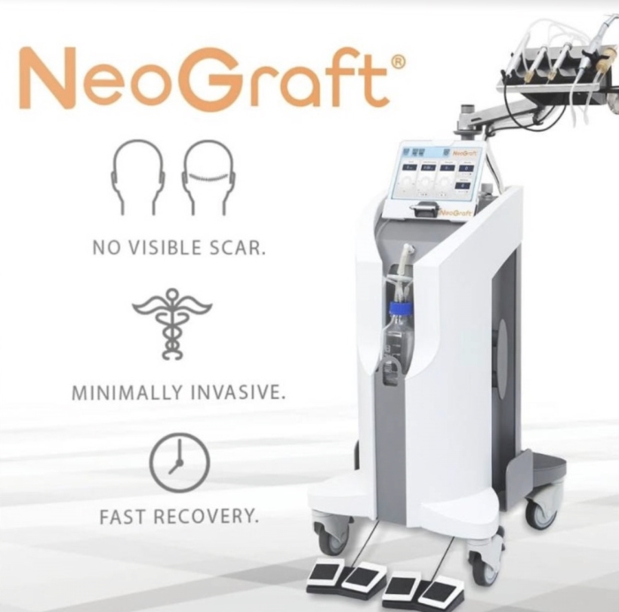 Neograft San Diego