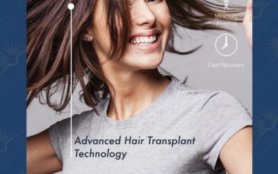 Female Hair Transplant Los Angeles