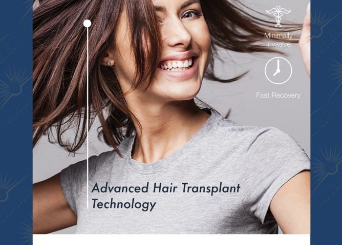 Female Hair Transplant Los Angeles