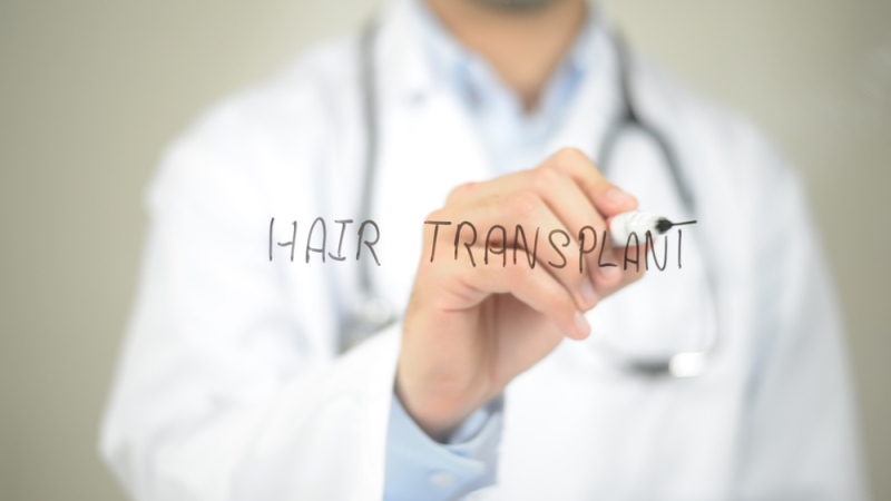 Reasons the Hair Transplant Market Continues to Grow