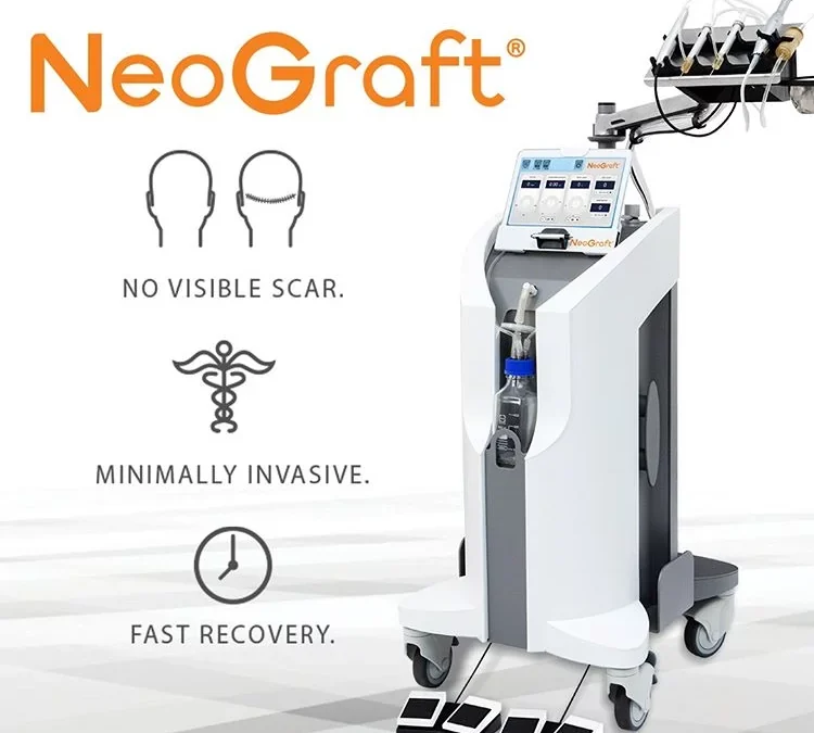 Restore Thinning Hair With a NeoGraft® Hair Transplant