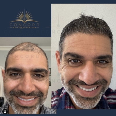 (c) Concordhairrestoration.com