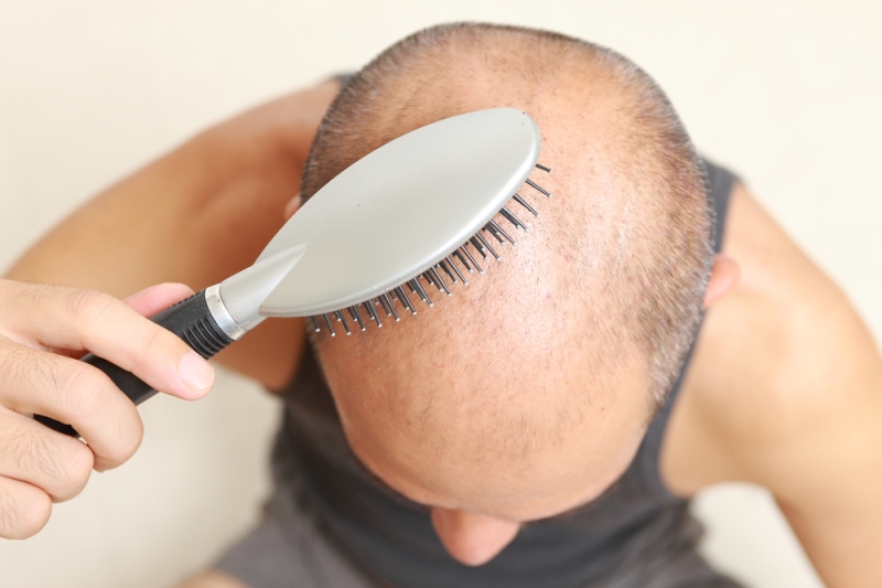 You Can Regrow Your Own Hair