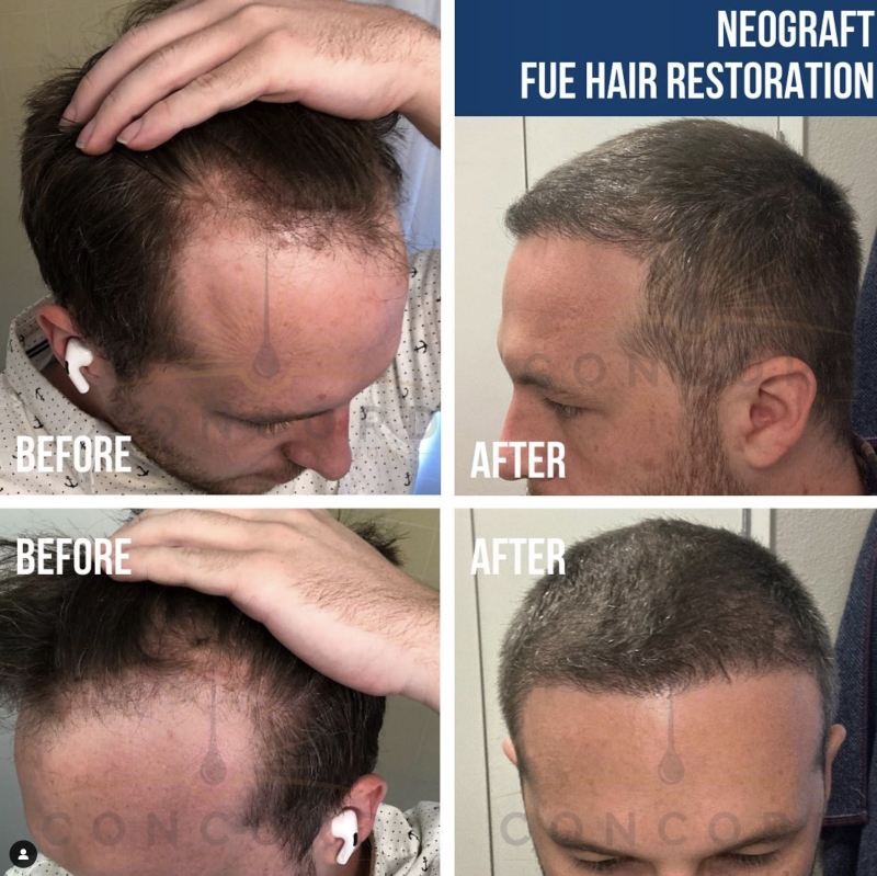 Hair Transplant Surgeon