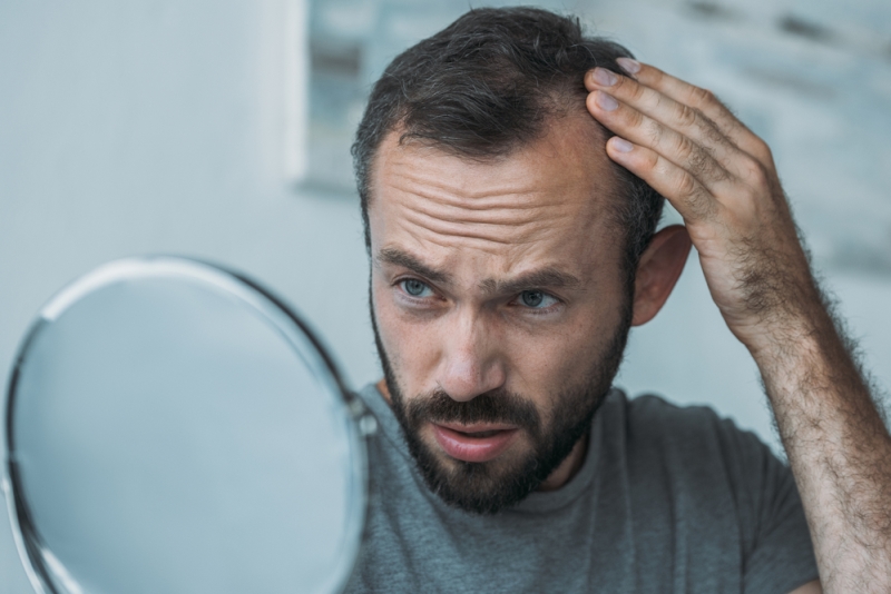 is a hair transplant risky?