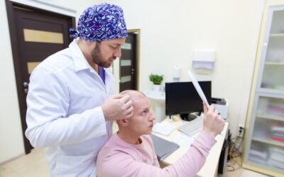 Things To Know When Considering A Hair Transplant