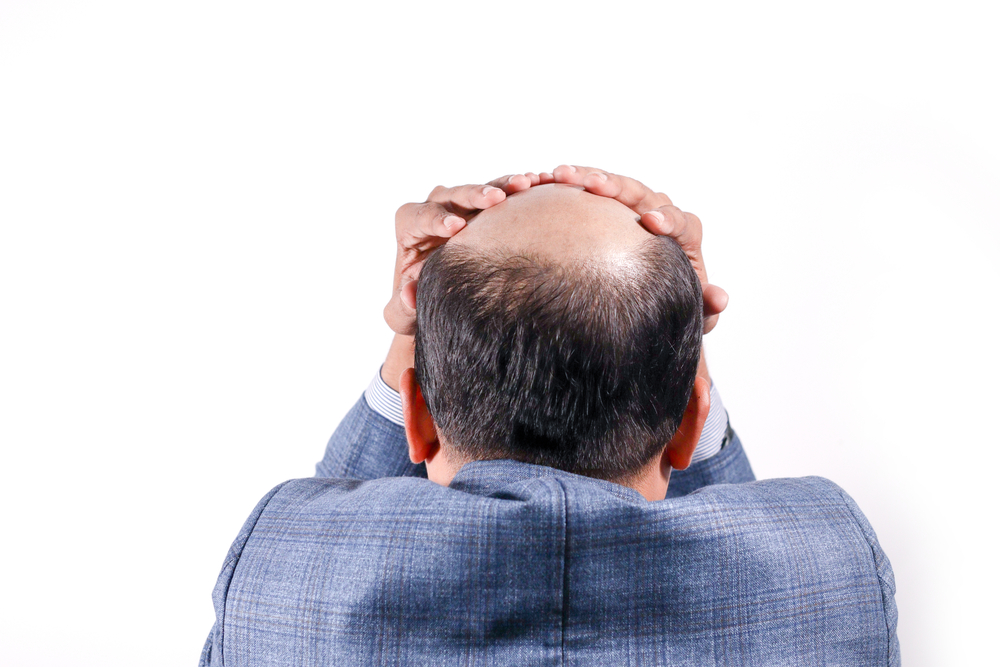 The 3 Worst Mistakes You Can Make When Choosing a Hair Loss Specialist