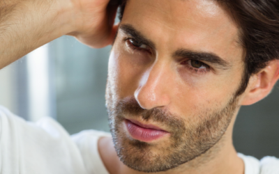 How Hair Loss in Men Affects Self-Esteem: Understanding the Impact and Finding Solutions