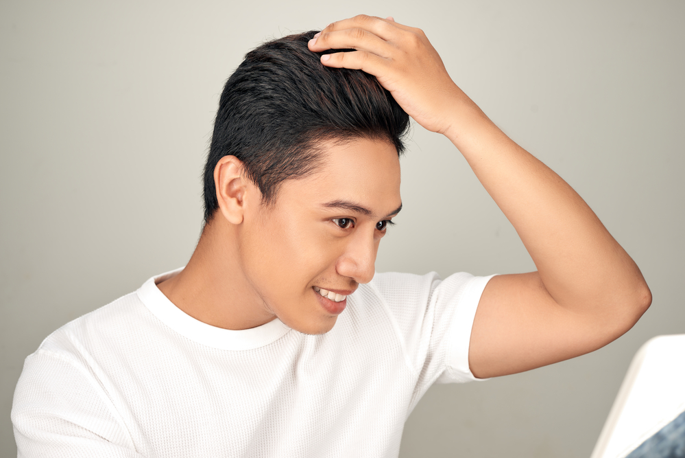 How to prepare for a hair transplant