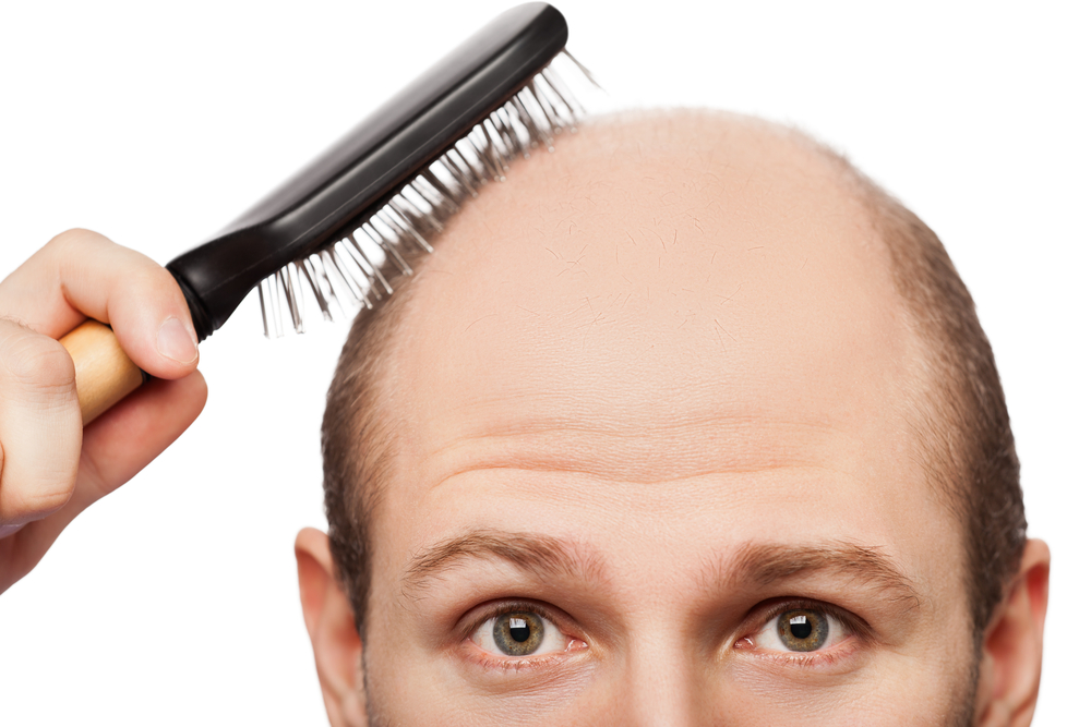 Young Men Hair Loss Causes: Unraveling the Mystery