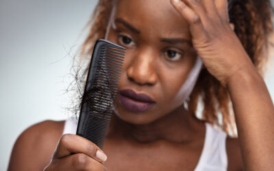 Why Is Women’s Hair Loss Different From Men’s?