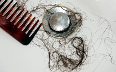 The Impact of Hormonal Imbalances on Hair Loss and How to Address It