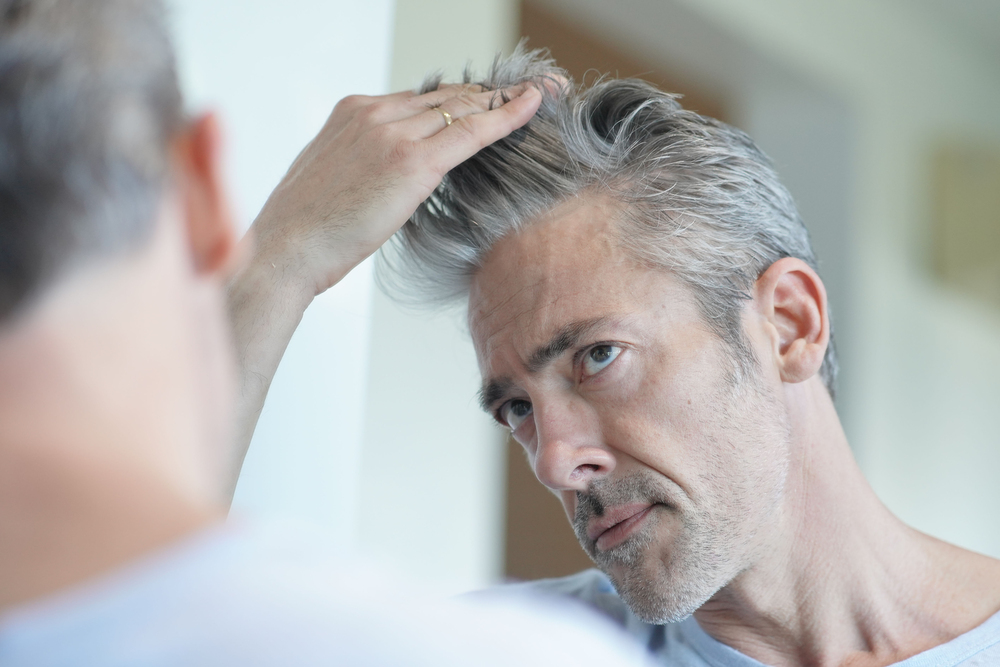 Seasonal Hair Loss: Why It Happens and How to Combat It