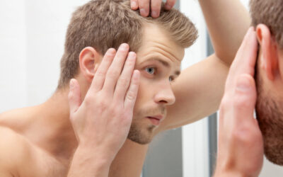 Hair Loss in Your 20s or 30s? How Our Clinic Addresses Young Adult Hair Transplants