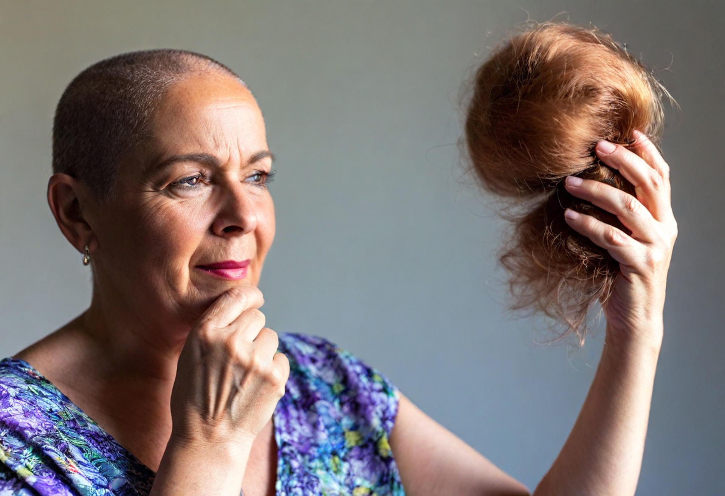 how Los Angeles weather can affect hair transplant recovery