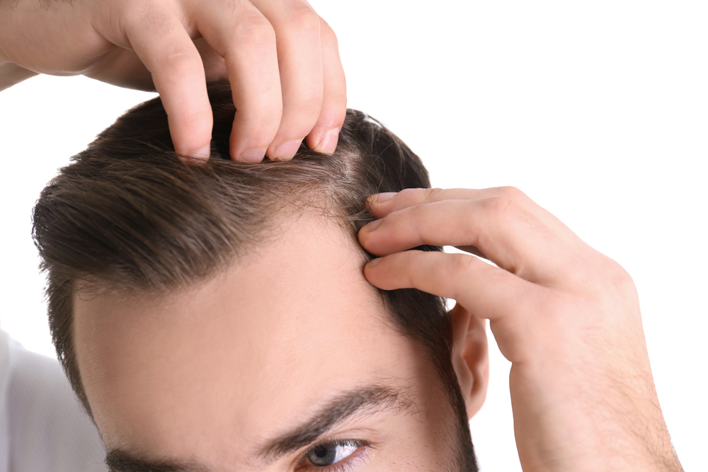 How Long Does It Take to See Hair Transplant Results? A Los Angeles Doctor Explains