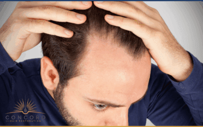 Temple Point Restoration in Los Angeles: The Hardest Area to Get Right