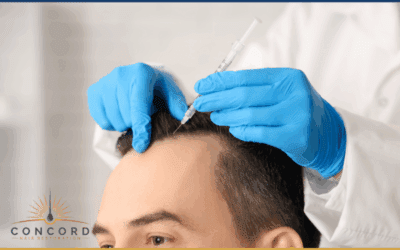 Hair Transplant Timeline Los Angeles | Week-by-Week Recovery Guide