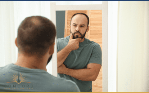 DHT Hair Loss in Men Explained | Treatment Options