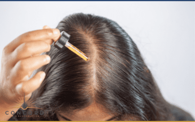 Can Minoxidil or Finasteride Affect Hair Transplant Results? What Patients Should Know