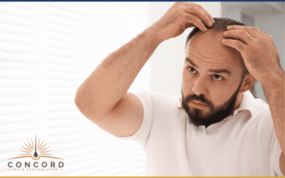 What Real Hair Transplant Results Look Like in Los Angeles (Month-by-Month Breakdown)
