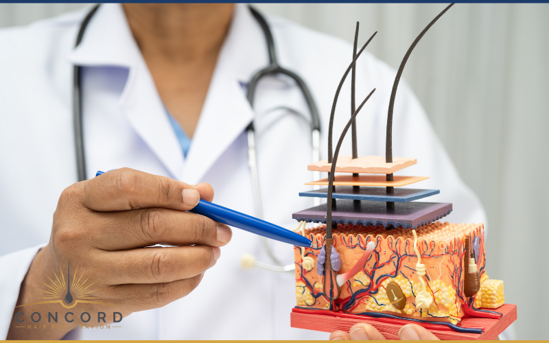 2026 hair transplant cost in Los Angeles