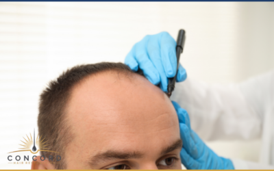 How to Choose a Hair Transplant Clinic in Los Angeles (Red Flags to Avoid)