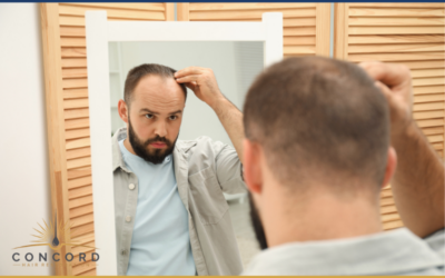 Is It Better to Get a Hair Transplant Early or Wait?
