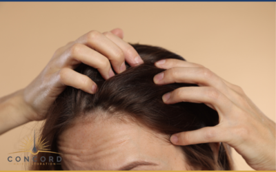 Why Natural Hairlines Matter More Than Hair Count in Hair Transplants