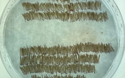 Can You Be Too Young for a Hair Transplant?