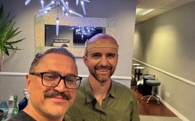 Dr. Ben Explains: The Biggest Hair Transplant Mistakes Patients Make Before Surgery