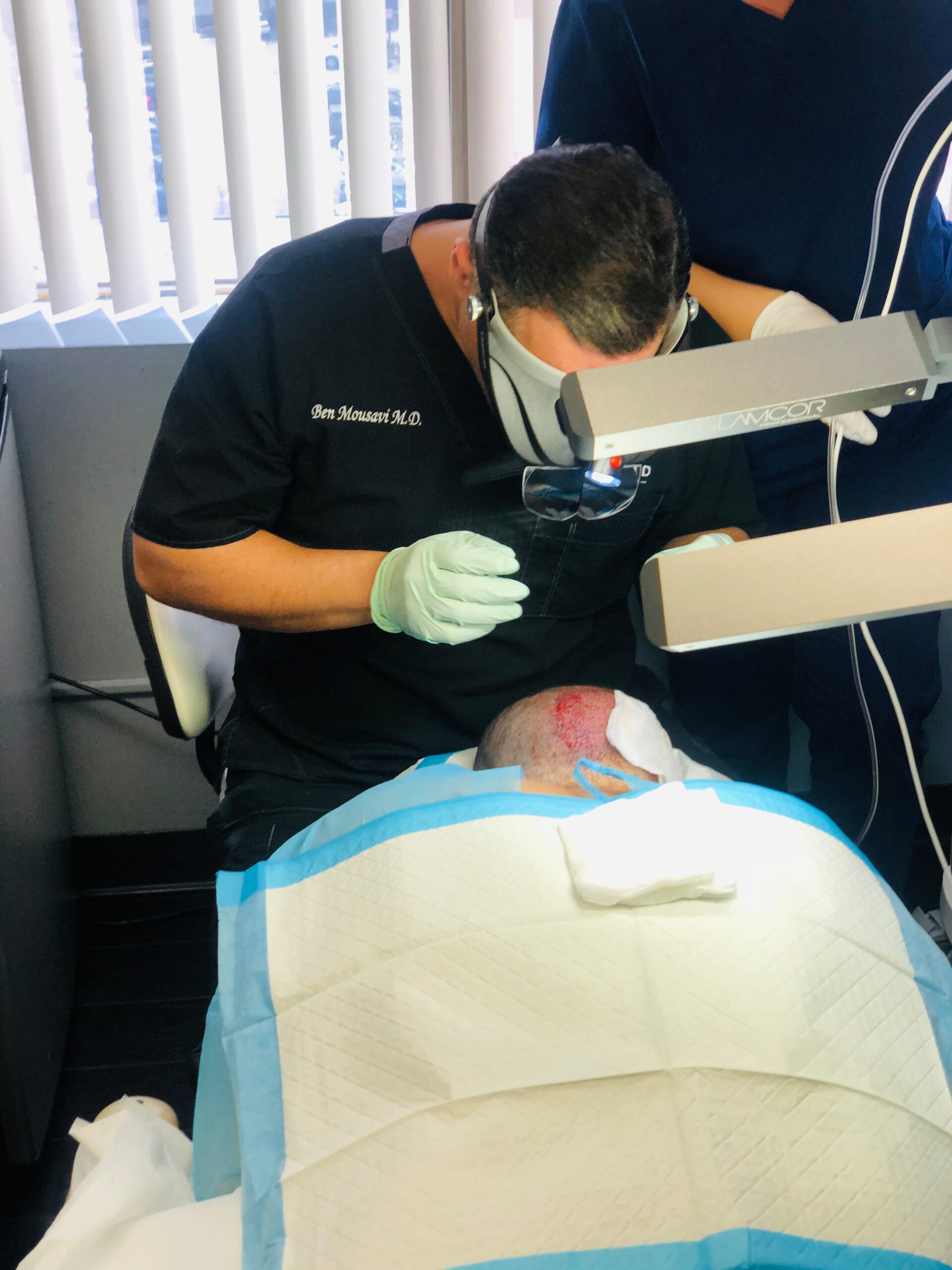 hair transplant clinic los angeles before and after results